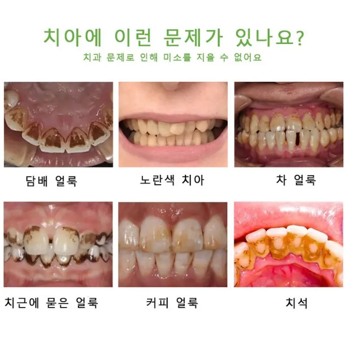 SILIYOUNG 3+2 치아미백 세럼 셀프 화이트닝 플라크 구강 위생 클렌징 얼룩 제거