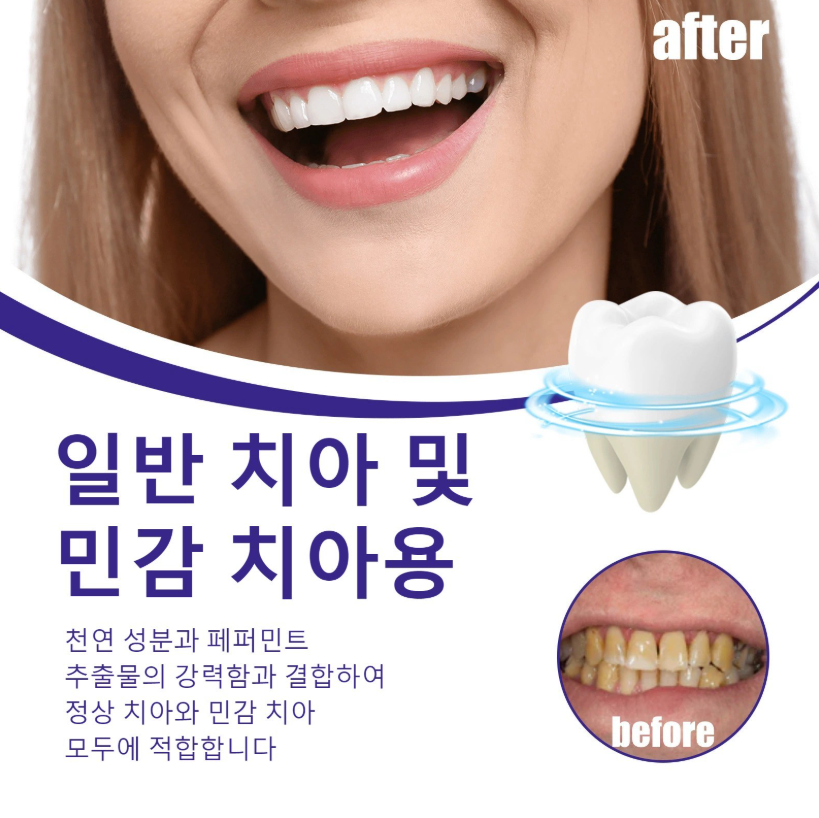 노란 치아 미백 파우더 / 강력 미백 / 치아 얼룩 케어 / 데일리 구강 케어/치아 착색 케어/휴대용치약