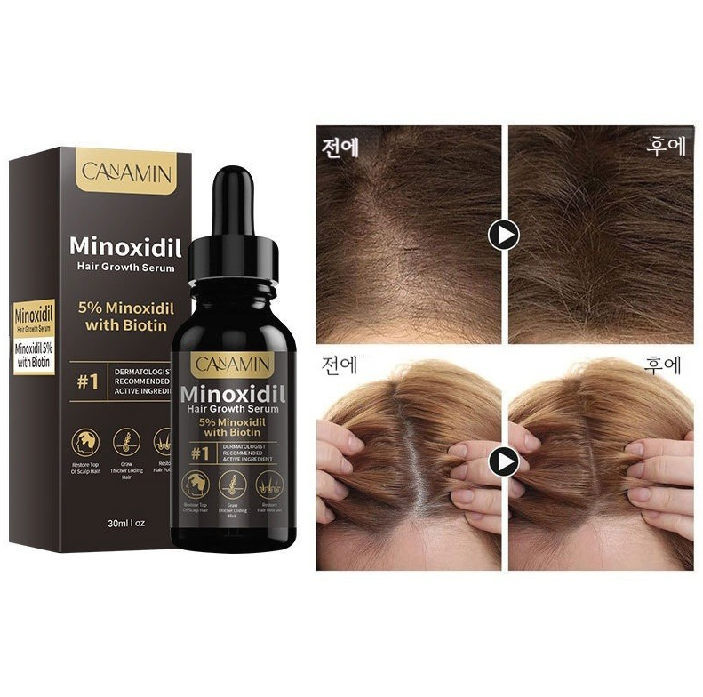두피 케어 앰플 영양 공급 보습 집중 관리 두피 에센스 남녀공용, 30ml