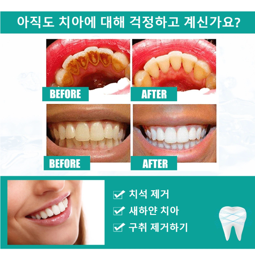 2+1/3+2 미백치약 치석제거 충치예방 입냄새제거 구강청결 치아미백 가루